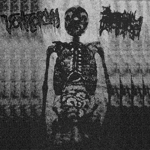 Serotonin Leakage : Serotonin Leakage - Vomitorium